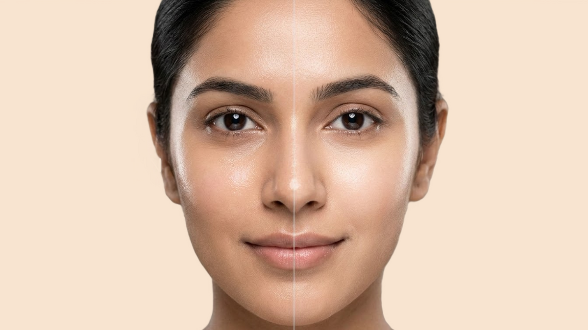 Alpha Arbutin vs Kojic Acid: Which Pigmentation Ingredient Wins?