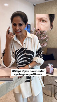 Dark Circles