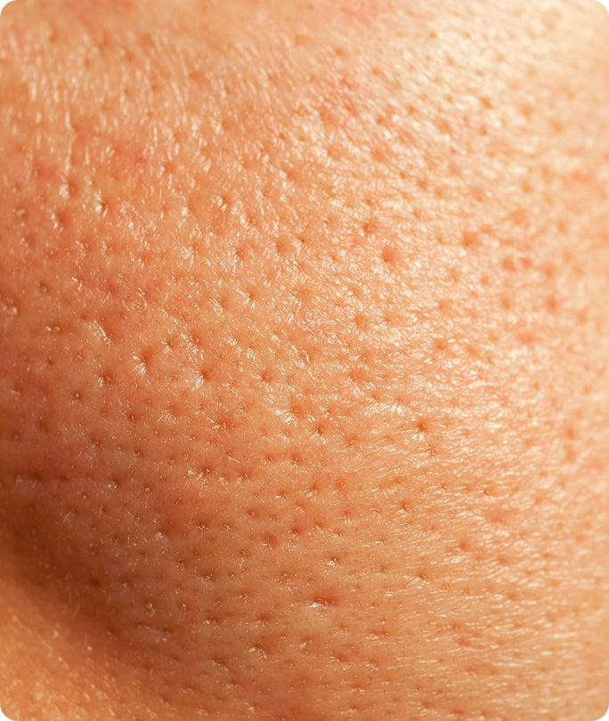Pores
