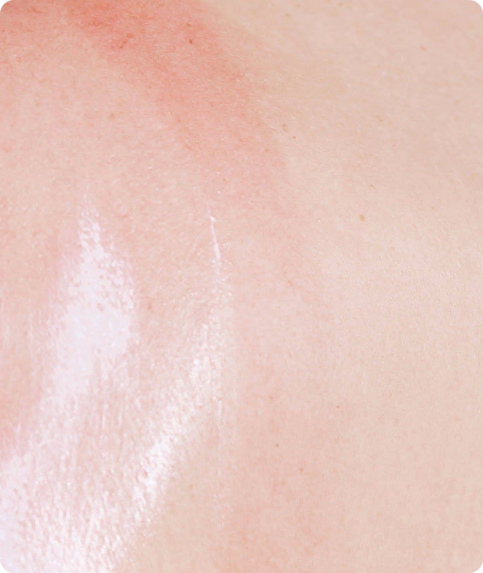 Sensitive Skin